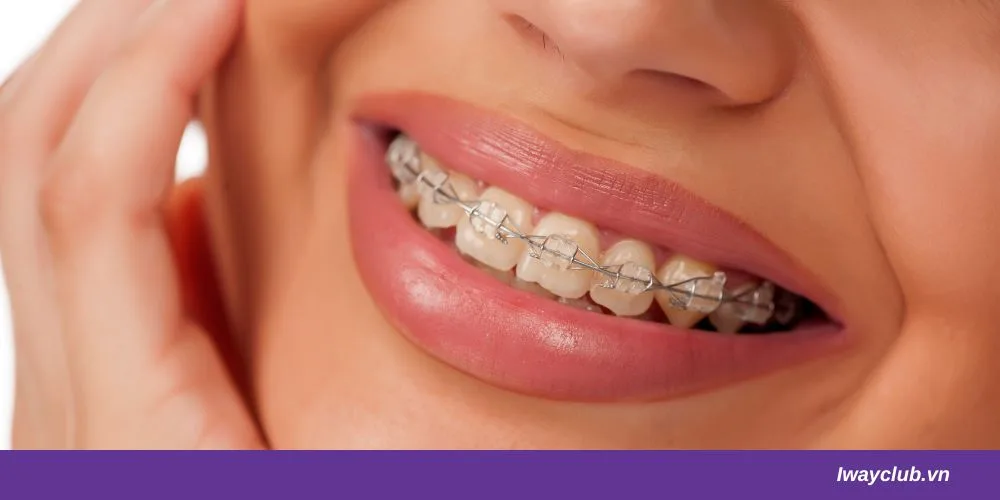 Giải Đáp: Đang Cho Con Bú Có Niềng Răng Được Không? 4 Tìm hiểu niềng răng khi cho con bú